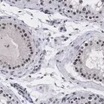 Merck Anti-UBR5 Antibody, clone 2F14 ZooMAb Rabbit Monoclonal