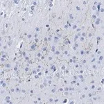 Merck Anti-Dopamine Transporter Antibody, clone 1D2 ZooMAb Rabbit Monoclonal