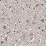 Merck Anti-Akt Antibody, PH Domain Antibody, clone SKB1 ZooMAb Mouse Monoclonal