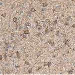 Merck Anti-MAP2 Antibody, clone AP20 ZooMAb Mouse Monoclonal