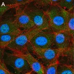 Merck Anti-Treslin Antibody, clone 5L19 ZooMAb Rabbit Monoclonal