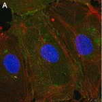 Merck Anti-Integrin αVβ3 Antibody, clone LM609 ZooMAb Mouse Monoclonal