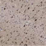 Merck Anti-GluR1 Antibody, clone RH95 ZooMAb Mouse Monoclonal