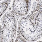 Merck Anti-FMR1 (C-terminal) Antibody, clone 2B16 ZooMAb Rabbit Monoclonal