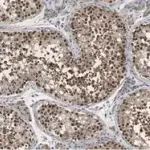 Merck Anti-PER2 Antibody, clone 1G17 ZooMAb Rabbit Monoclonal