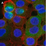Merck Anti-PVR (CD155) Antibody, clone 4B3 ZooMAb Rabbit Monoclonal