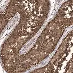 Merck Anti-FKBP52 Antibody, clone 4H21 ZooMAb Rabbit Monoclonal
