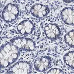 Merck Anti-SUPV3L1 Antibody, clone 2F5 ZooMAb Rabbit Monoclonal