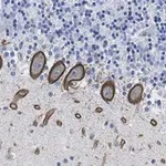 Merck Anti-PKCδ Antibody, clone 1C13 ZooMAb Rabbit Monoclonal