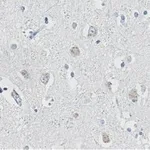 Merck Anti-APP Antibody, clone 1F22 ZooMAb Rabbit Monoclonal