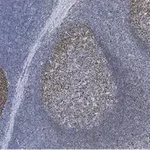 Merck Anti-Rb Antibody, clone 2M15 ZooMAb Rabbit Monoclonal