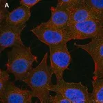 Merck Anti-phospho-Stat1-Tyr701 Antibody, clone 1F23 ZooMAb Rabbit Monoclonal