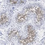 Merck Anti-PPP3CC Antibody, clone 2C2 ZooMAb Rabbit Monoclonal