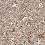 Merck Anti-Neurofilament L Antibody, clone 1E13 ZooMAb Rabbit Monoclonal