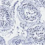 Merck Anti-PIAS Antibody, clone 1O17 ZooMAb Rabbit Monoclonal