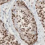 Merck Anti-REST Antibody, clone 2E3 ZooMAb Rabbit Monoclonal