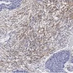 Merck Anti-Zyxin Antibody, clone 2F17 ZooMAb Rabbit Monoclonal