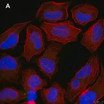 Merck Anti-p-Ubiquitin (pSer65) Antibody, clone 2N21 ZooMAb Rabbit Monoclonal