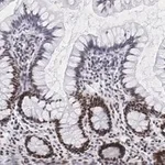 Merck Anti-Nucleolin Antibody, clone 5D13 ZooMAb Rabbit Monoclonal
