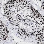 Merck Anti-POLR2A Antibody, clone 3G21 ZooMAb Rabbit Monoclonal