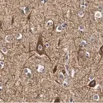 Merck Anti-Neurofilament M Antibody, clone 1B23 ZooMAb Rabbit Monoclonal