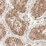 Merck Anti-Anillin Antibody, clone 2C6 ZooMAb Rabbit Monoclonal