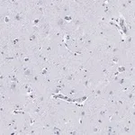 Merck Anti-Neurofilament H Antibody, clone 5L10, ZooMAb Rabbit Monoclonal