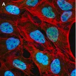 Merck Anti-NCOA1 Antibody, clone 5B9, ZooMAb Rabbit Monoclonal