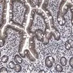 Merck Anti-ATM Antibody, clone 4N19, ZooMAb Rabbit Monoclonal