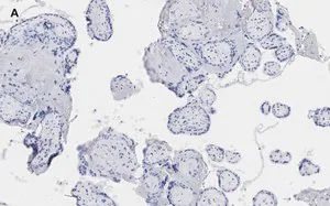 Merck Anti-BCRP (ABCG2) Antibody, clone 10K5 , ZooMAb Rabbit Monoclonal