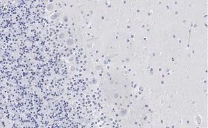 Merck Anti-Aldolase C Antibody, clone 3B18, ZooMAb Rabbit Monoclonal