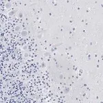 Merck Anti-Aldolase C Antibody, clone 3B18, ZooMAb Rabbit Monoclonal
