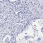 Merck Anti-EpCAM Antibody, clone 1B8 , ZooMAb Rabbit Monoclonal