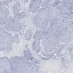Merck Anti-TAGLN Antibody, clone 1D10 , ZooMAb Rabbit Monoclonal