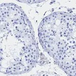 Merck Anti-Androgen Receptor Antibody, clone 3K11 , ZooMAb Rabbit Monoclonal