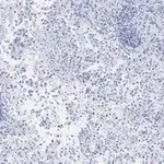 Merck Anti-Integrin αVβ5 Antibody, clone EM09902 , ZooMAb Rabbit Monoclonal