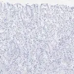 Merck Anti-ALDH1A1 Antibody, clone 4J6, ZooMAb Rabbit Monoclonal