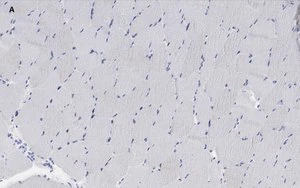 Merck Anti-alpha Actinin 2 Antibody, clone 1E11, ZooMAb Rabbit Monoclonal