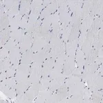 Merck Anti-alpha Actinin 2 Antibody, clone 1E11, ZooMAb Rabbit Monoclonal