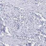 Merck Anti-Peripherin Antibody, clone 1D4, ZooMAb Rabbit Monoclonal