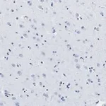 Merck Anti-APP Antibody, clone 5D16, ZooMAb Rabbit Monoclonal