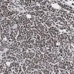 Merck Anti-phospho-IRS1 (Tyr612) Antibody, clone 1N14, ZooMAb Rabbit Monoclonal
