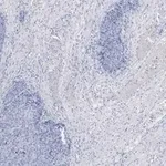 Merck Anti-Calponin 1 Antibody, clone 9D14, ZooMAb Rabbit Monoclonal