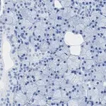 Merck Anti-TMEM16A Antibody, clone 3J18, ZooMAb Rabbit Monoclonal