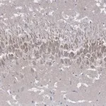 Merck Anti-NMDAR2A Antibody, clone A12W, ZooMAb Rabbit Monoclonal