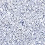 Merck Anti-Calbindin D-28K clone 1A11 Antibody, ZooMAb Rabbit Monoclonal