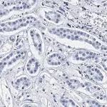 Merck Anti-Smad3 Antibody, clone 1J11, ZooMAb Rabbit Monoclonal
