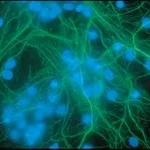 Merck Anti-Neurofilament 200 antibody produced in rabbit
