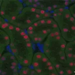 Merck Anti-HNF1B antibody produced in rabbit