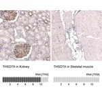 Merck Monoclonal Anti-THSD7A antibody produced in mouse